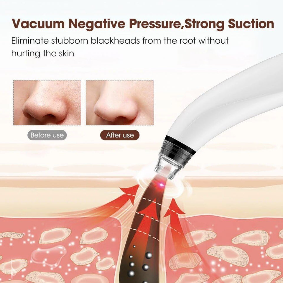 Electric Blackhead Remover Vacuum,