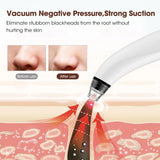 Electric Blackhead Remover Vacuum,