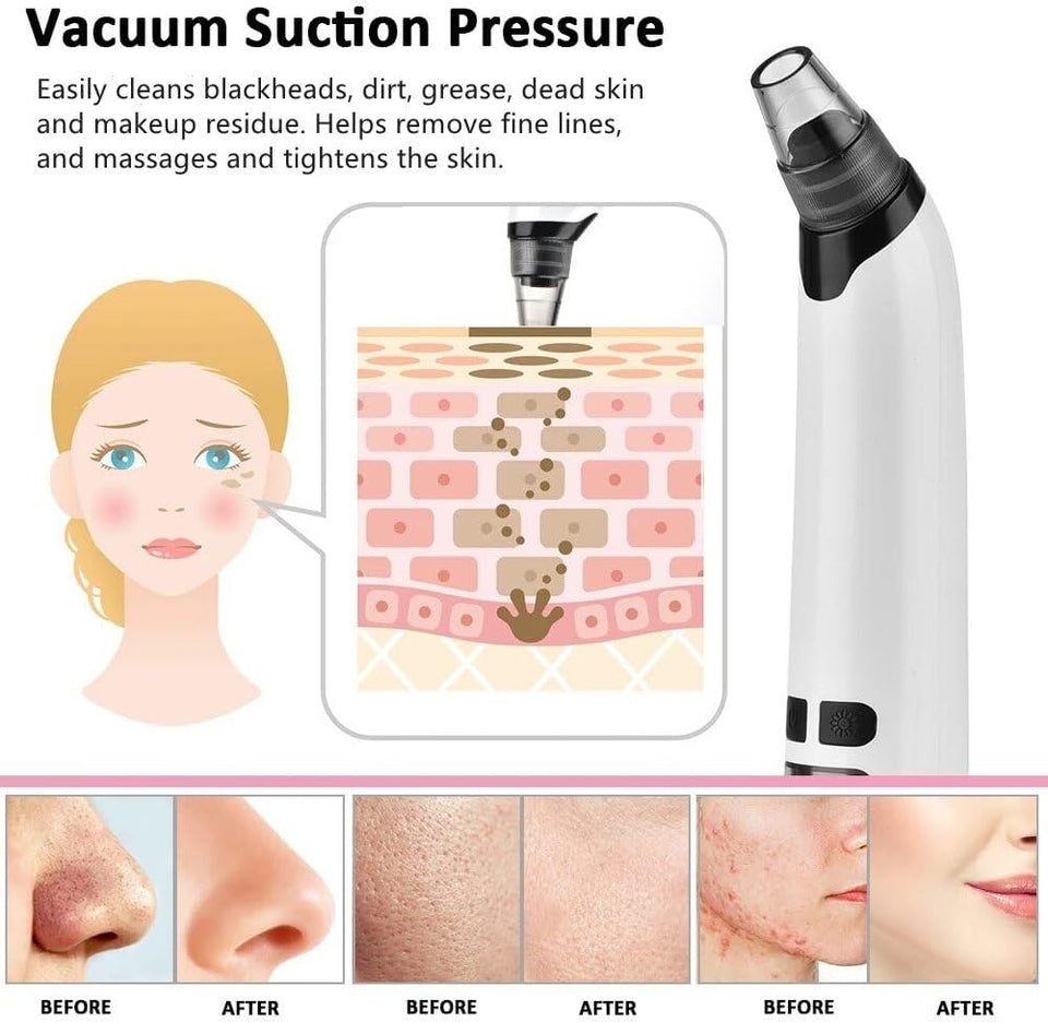 Electric Blackhead Remover Vacuum,